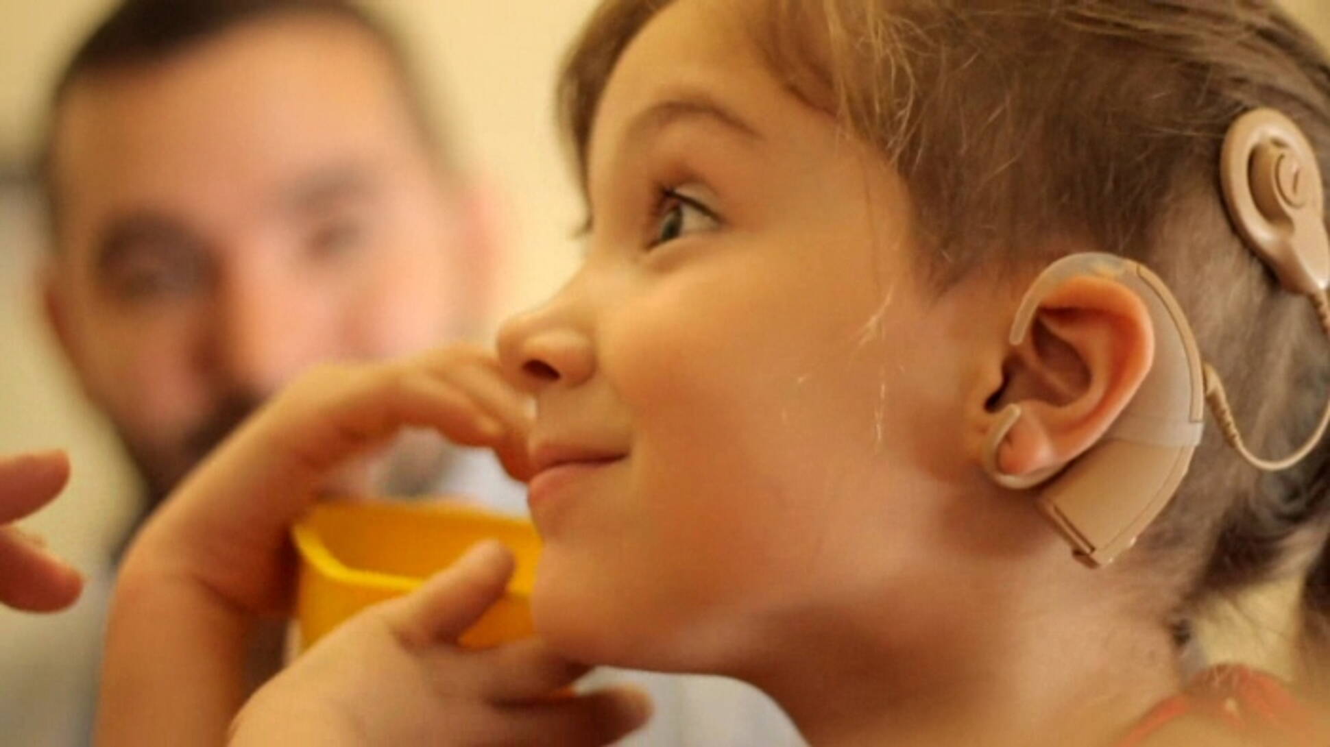 Más de 100 niños con hipoacusia recibirán implantes y audífonos