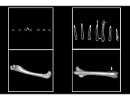 Científicos del Conicet lograron regenerar tejido óseo