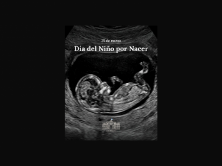 25 de marzo: Argentina conmemora el Día del Niño por Nacer