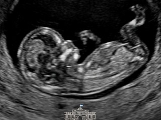 25 de marzo: Argentina conmemora el Día del Niño por Nacer